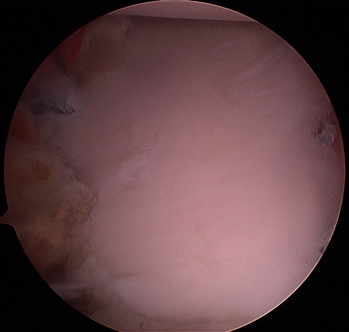 ch1 image 022